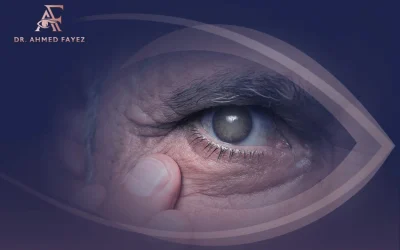 ما هو علاج المياه البيضاء في العين