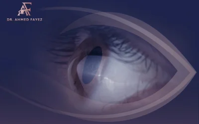 علاج القرنية المخروطية 