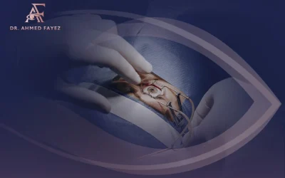 هل يتغير شكل العين بعد عملية انفصال الشبكية