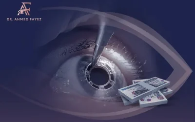أهم العوامل المؤثرة في تكلفة عملية زرع العدسات