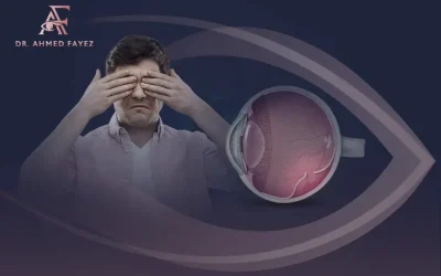 هل انفصال الشبكية خطير؟ تعرف إلى سبل الوقاية من مضاعفاته