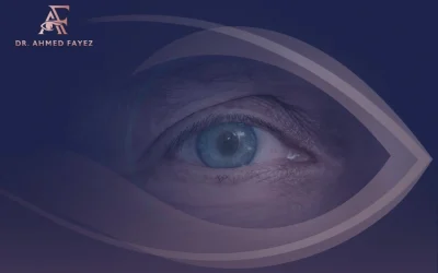 شكل العين بعد عملية المياه البيضاء