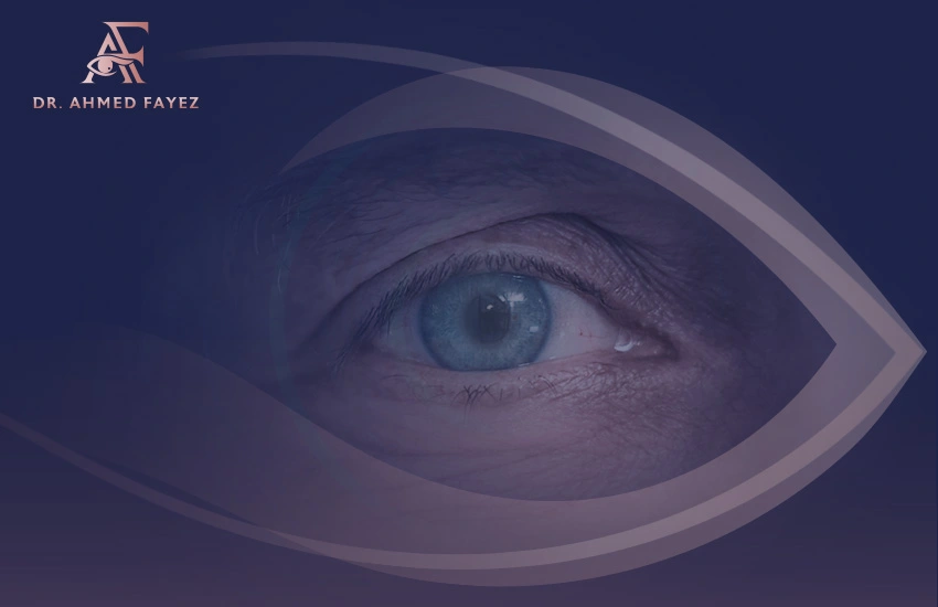 شكل العين بعد عملية المياه البيضاء