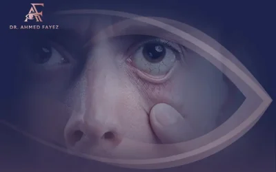 علاج جفاف العين