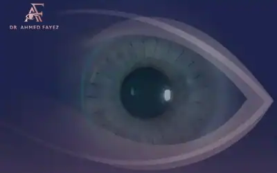 إليك كل ما ترغب في معرفته عن عملية ترقيع القرنية